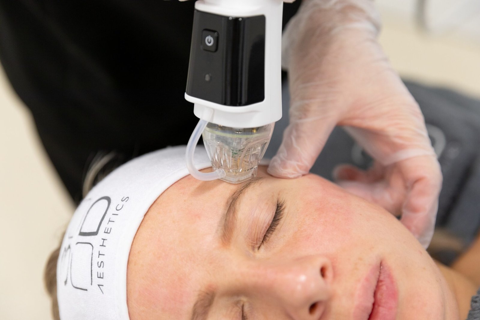 client recieving dermaforce advanced radiofrequency treatment on face